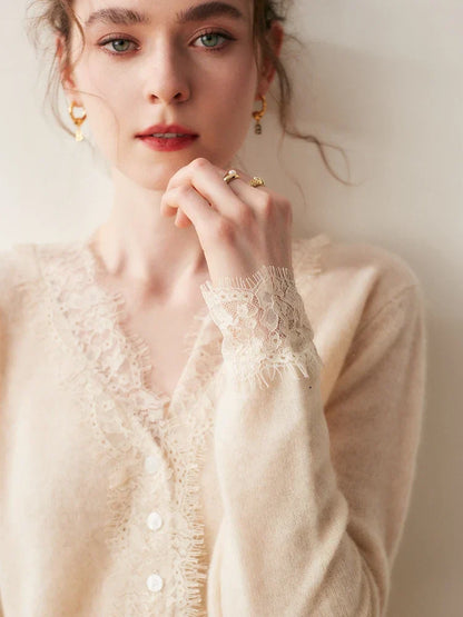 Rosie Fitted Cardigan | Lace Trim Button Front Cardigan